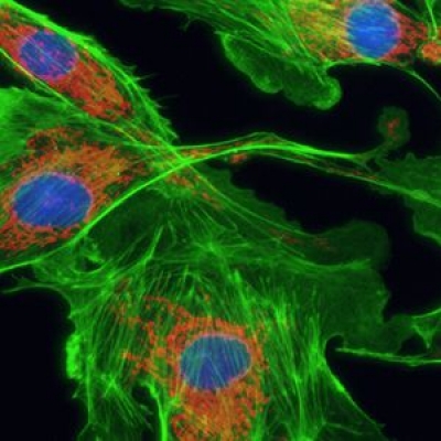 怎么提高顯微鏡的熒光成像的質量？